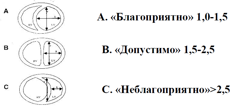 Отношение передне-заднего размера ЛЖ к боковому в фазу систолы